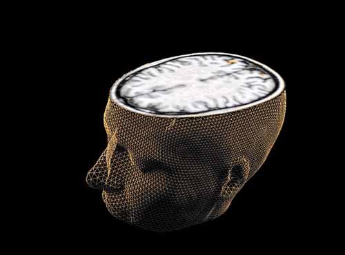 Novas tecnologias ajudam a identificar atividade cerebral com precisão. Foto: Sage Center for the Study of the Mind/Divulgação