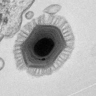 Foto mostra o megavírus chilensisa, que detinha o recorde de maior vírus até o momento, com 1200 genes. Crédito: IGS-CNRS/AFP/File C. Abergel. (IGS-CNRS/AFP/File C. Abergel )