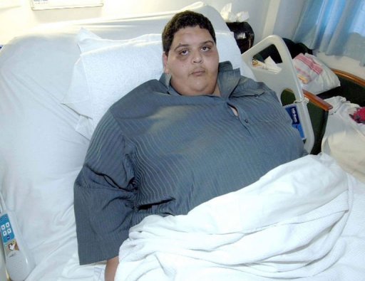 Outro saudita realizou cirurgia para a retirada de 80kg de gordura de seu estômago. Foto: AFP 