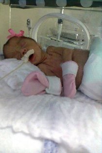 Bebê Sofia resistiu por dois meses e foi negociada desde o 14° dia de vida (Arquivo Pessoal)