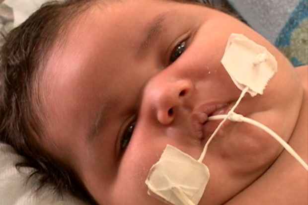 Bebê nasceu com aumento do coração devido a diabetes gestacional da mãe. Foto: Reprodução/TV Clube